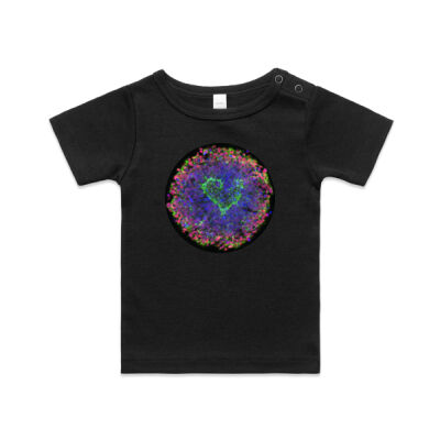 Syngap heart infant shirt Thumbnail